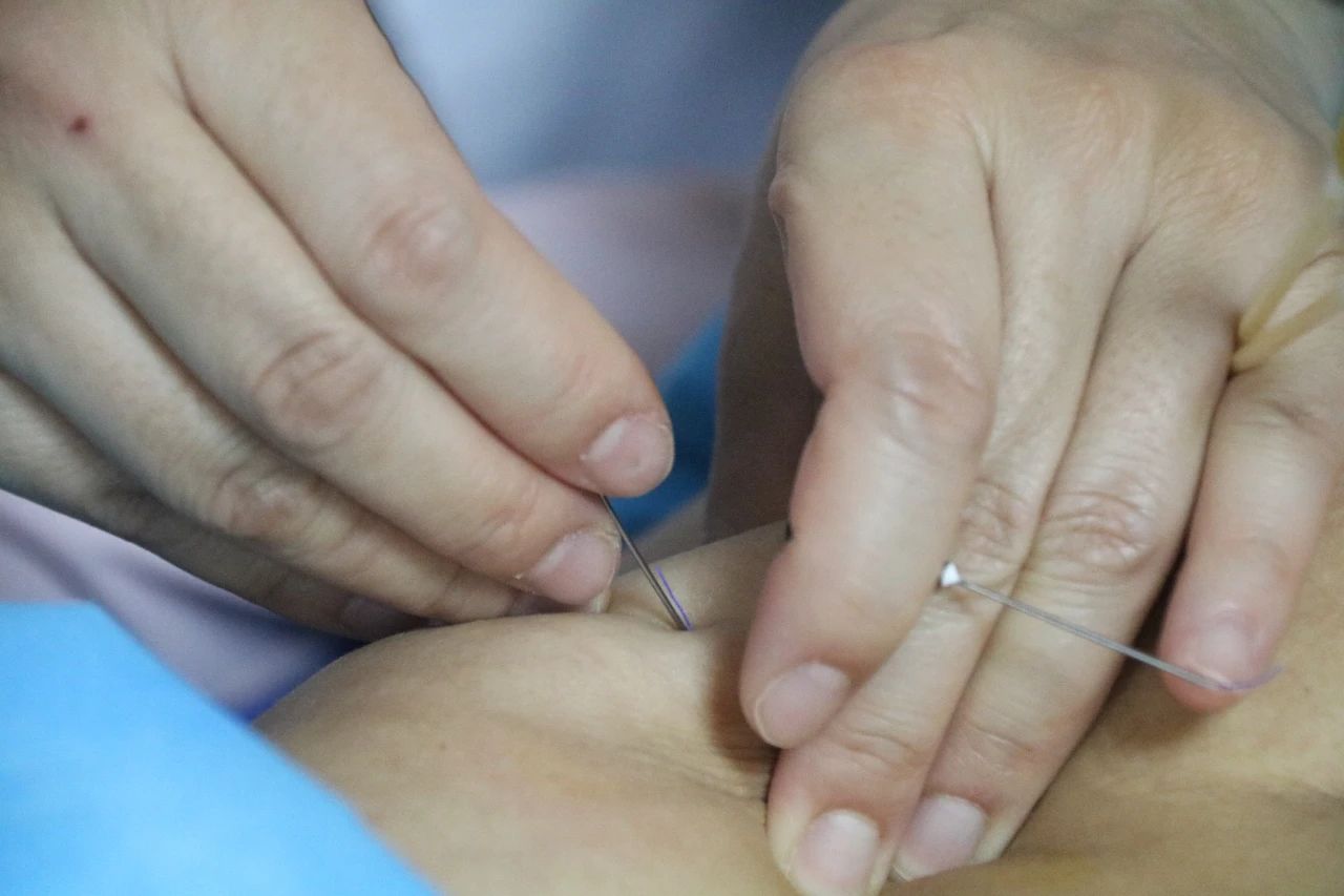 减肥，中医出奇招 ！15分钟埋线 =“躺着瘦”？大理中医提醒......