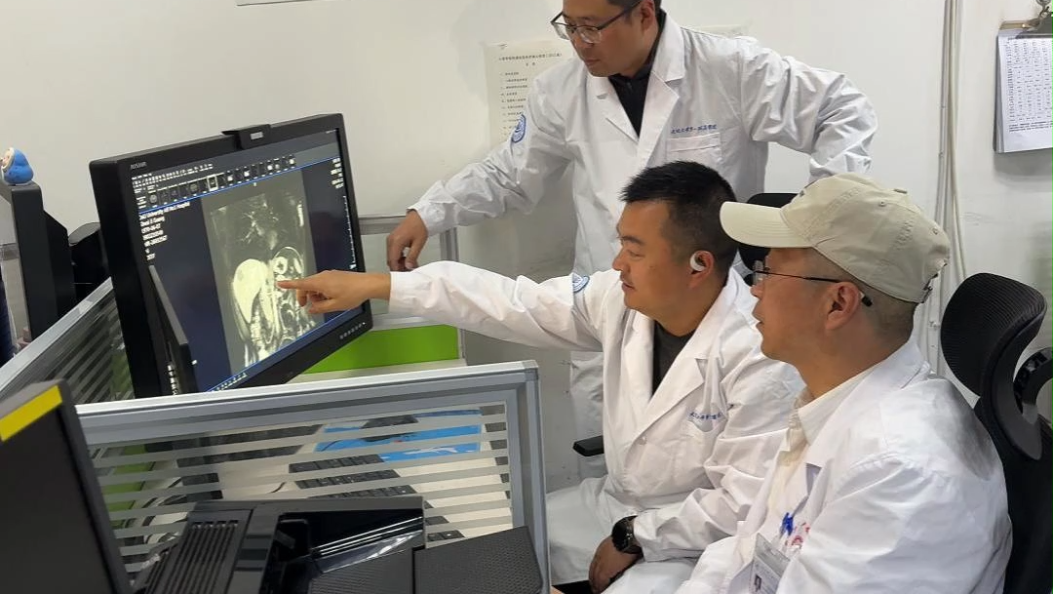 这项新突破，让肝癌早期发现率得到提高 #在大理爱上生活